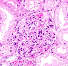 What structure can you see with the light microscope surrounding the glomerulus?
