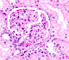 What is the clear space between the glomerulus and the parietal layer of Bowman's capsule called? What does this space contain?