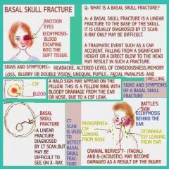 Basilar skull fracture may extend to nasal sinus or middle ear

•Rhinorrhea

•Otorrhea

•Battle’s sign

•Raccoon eyes




•Risk for infection if CSF leakage