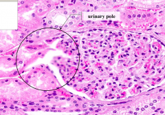 Urinary Pole
- Where plasma ultrafiltrate exits the renal corpuscle