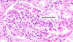 Proximal Tubule
- This is the first place the plasma ultriafiltrate enters into