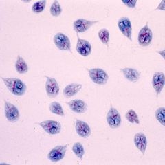 Protozoa Identification