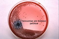 Tests γ (gamma) hemolytic colony for oxidase & Neisseria spp. using oxidase reagent
-NEG= cream color= NO oxidase= NOT Neisseria spp.
+POS= Pink/Purple/Black= +Oxidase= Neisseria spp.