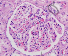What kind of cells are circled? How can you tell?
