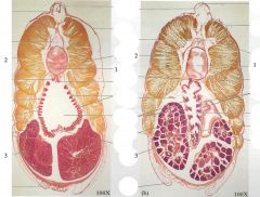 dorsal fin, dorsal nerve cord, notochord, myomeres, atrium, pharynx, gill bars, hepatic cecum, ovary (female) or testis (male)