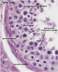 “Belt” formed by tight junctions between sertoli cells 
•	Separates spermatogonia from primary spermatocytes → divides the tubules into a “basal” and “adluminal” compartment (see diagram above) 
•	Prevents immune response to pr...
