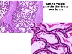 Produces seminal fluid
•	Diverticulum of the vas deferens 
•	Covered by CT
•	Lumen is confluent with that of the vas.
•	Histologically → coiled tubules, lined with columnar epithelium