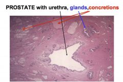 Synthesizes and secretes prostatic fluid 
•	Single, midline gland, lies inferior to bladder  
•	Ejaculatory ducts enter prostate, where they meet with urethra 
•	Urethra then brings urine or ejaculate from prostate → penis
•	Concreti...