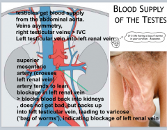 Right testicular vein > directly IVC
Left testicular vein > left renal vein
==> Asymmetry

Blockage left renal vein 
> cause: Superior mesenteric artery compression of left renal vein (b/c anterior left renal vein, see diagram drawn)
>result: Bac...