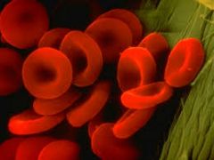 1.-  Hiperplasia de percusores de células de médula ósea.
2.- aumento de células en sangre periférica
3.- sobre producción de glóbulos rojos.
4.- aumento del volumen eritrocitario.