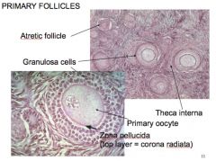 •Lack of antrum (fluid-filled chamber) 
•Follicular/Granulosa cells form stratified cuboidal epithelium --> Contains primary oocyte