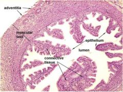 Where secondary oocyte travels after ovulation 
Where fertilization occurs
 .	Forms Fimbriae : Finger-like projections that open up beside the ovary 
•	Eggs are “swept” into oviducts via ciliary movements of fimbriae. 
•	Fallopian tube...