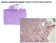 •“Shed, broken, bloody tissue”
•Endometrial gland and coiled blood vessels are shed 

Only stratum basalis is left behind → begins new growth cycle