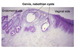 Junction between uterus & vagina
•	See epithelium transitioning from endometrial → vaginal
•	Endometrial side: Simple columnar with lots of invaginations & glands
•	Vaginal side: no glands, stratified squamous