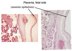 placenta fetal side