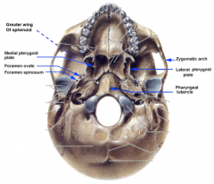 lateral pterygoid plates
medial pterygoid plates
zygomatic arches
pharyngeal tubercle
foramen ovale/spinosum
foramen magnum