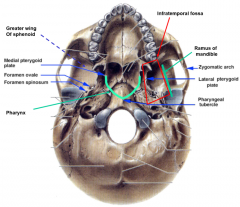 laterally: medial pterygoid plates and ramus of mandibleanteriorly: posterior surface of maxilla
posteriorly: mandibular fossa (TMJ), styloid process, carotid canal
superior: wing of sphenoid bone
inferior: medial pterygoid muscles