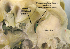 posterior: pterygoid plates of sphenoid
anterior: palatine bones of palate (medial to maxilla)


pterygopalatine fissure= opening