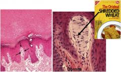 mechanoreceptors for fine touch located in dermal papillae
