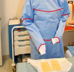 Back of sterile gown is considered un-sterile after donned.
Avoid changing table levels when possible.