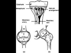 intra-articular metaphyses: prox humerus, proxradius, prox femur, dist fibula/tibia. 2^  direct metaphyseal spead osteo. metaphysis knee extra-articular proxl tibial distal femur osteo NOT spread knee. Ans5