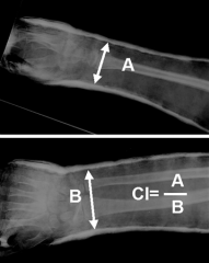 prepg to cast a child w/ both-bn forearm fx in ER. Durg cast app, all are directly related to the risk of thermal injury except? 1-Layers thickness castg; 2-Water temp used to dip castg ; 3-Placg limb on pillow durg the cast curg;