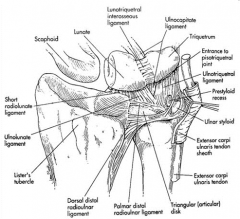 Which of the following structures is an anatomical component of the TFCC? 1-ECU tendn sheath; 2-Lunotriquetral interosseous lig; 3-EDM tendon sheath; 4-Radioscaphocapitate lig; 5-FCU tendon sheath