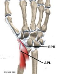 31yo F of a 2-mth-old infant c/o of radial sided wrist pn. Corticosteroid injections should be directed into what anatomic area? 1-1st CMC jnt; 2-Carpal tunnel 
3-1st dorsal comprtmnt near the radial styloid;