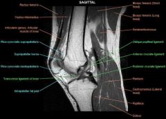 sagittal  
  evaluate menisci, 
cruciates, cartilage,
 extensor mechanism