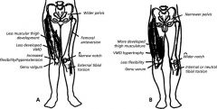 1landing biomechanics and neuromuscular control differences
2 conditioning and strength play the biggest role- females land with their knees in more extension and valgus due to hip internal rotation 
  3  smaller notches
  4  smaller ACL size
   5 cyc