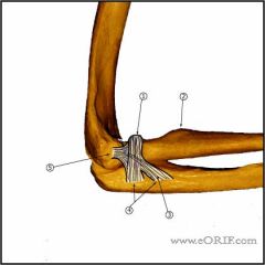 What is the most common mode of failure of the lateral ulnar collateral ligament associated with an elbow dislocation?