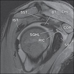 Besides the biceps tendon, which of the following structures also pass through the rotator interval?