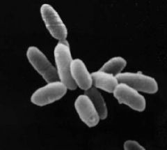 Les archées forment un groupe de micro-organismes unicellulaires. Comme les bactéries, elles ne présentent ni noyau ni organites intracellulaires. Les archées s’en distinguent par certains caractères biochimiques, comme la constitution de la membrane cell