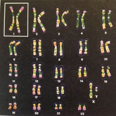 Cartographie des chromosomes lors de la division cellulaire. Formation des paires et détection des aberrations chromosomiques.