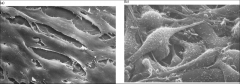 Which one of these is the transformed Fibroblast?
