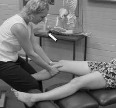 Loss of P-A glide or distraction (locked knee)