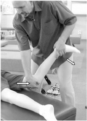 Pressure is directed against the posterior medial aspect of the distal leg in a direction of knee extension and slightly lateral. Thigh must be kept in position of extension and abduction.
