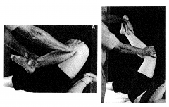 ER on fully flexed knee with VALGUS stress
Extent- Clunk at about 40o flexion
- Deficiency of PCL  (grade 1 or 2 tear)