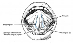 frenulum attaches to floor (tongue tied)
deep lingual veins
opening of submandibular duct on sublingual papilla