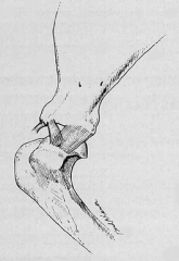 medial shoulder view