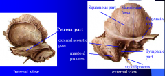 Lie inferior to parietal bones 
Contributes to the middle and posterior cranial fossae 
Form the inferolateral portion of the skull 
Squamous region- flat area of bone which contains bar like zygomatic process; zygomatic process projects anteriorl...