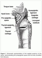 Anterior to epiglottis
Extends from hyoepiglottic ligament/vallecular to thyroid cartilage/thyroepiglottic ligament, bounded anteriorly by thyrohyoid membrane