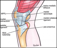 The fem attachment of the (MPFL) is located b/t the fem med epicondyle and the add tubercle.  During lat patellar dislocation, the fem attachment of the MPFL is a common site of injury & avulsion. Traumatic inj or laxity to the MPFL can cause futu...