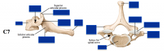 C7 Vertebra
 
-Transverse process
-Transverse foramen
-Articular facets
-Body
-Pedicles
-Lamina
-Spinous process