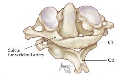 The joint between the atlas and the axis


 


Three sites of articulation:


 


1. The midline articulation between the anterior arch of the atlas and the dens of the axis allows for rotary movement (as in shaking your head “no”).
...