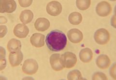 What leukocyte is this?