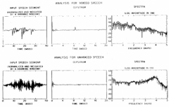 A cepstrum is the result of taking the Inverse Fourier transform (IFT) of the logarithm of the estimated spectrum of a signal.
Helps to differentiate noise-like and quasi-periodic sounds, helps to separate information about transfer function and f...