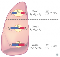 Zone 1: Apex of lung (~3) because there is not enough perfusion for the amount of ventilation