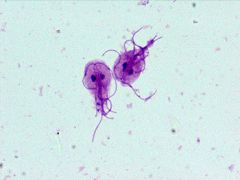 Has mitosomes which are special mitochondria without electron transport chain.  Is an animal parasite. Has flagella. Has two equal sized nuclei. Is an anaerobe. 


Ex.  Giardia (Intestinal parasite) usually transmitted by water infested by Giardia...
