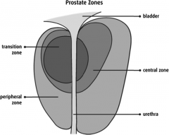 Which zone of the prostate is the common site for carcinoma?

